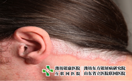 摄图网_327944169_耳部和颈部的psorp丝虫病（企业商用）
